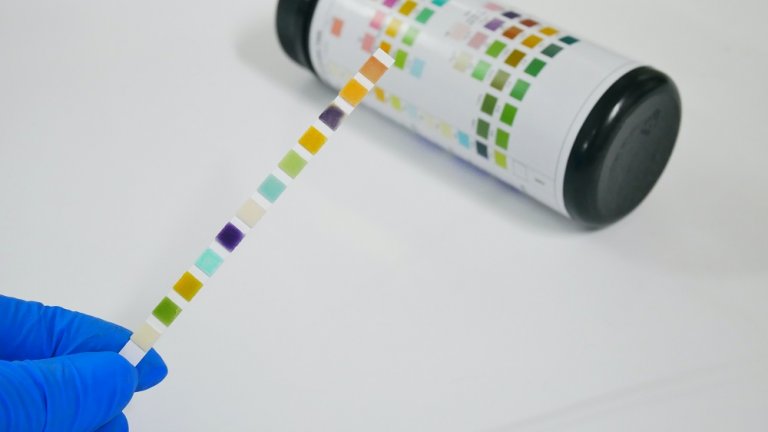 Cat Urinalysis Test: How It's Performed, What It Includes, and What It ...
