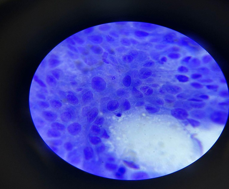 Close up microscope view of purple cells, suspected to be basal cells.