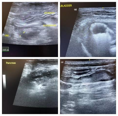 Four grey/black/white sonogram images showing the bile duct, gallbladder, pancreas, and intestinal tract lymph node of cats.