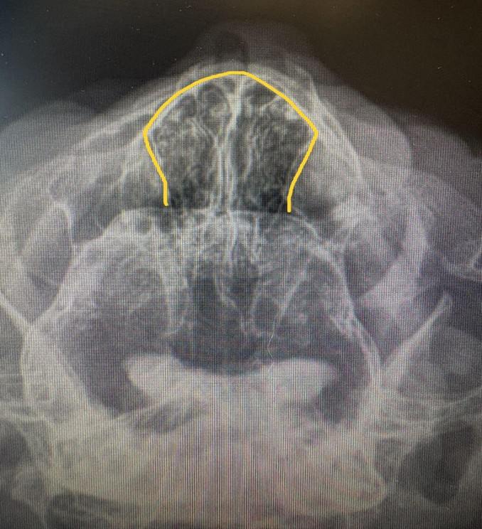 X-ray image close-up of a cat’s skull, showing the fine lined layers of the turbinates in the nasal passages.